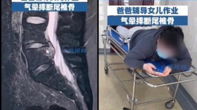 教女儿功课十几遍教不会 中国父亲气到摔断尾椎骨