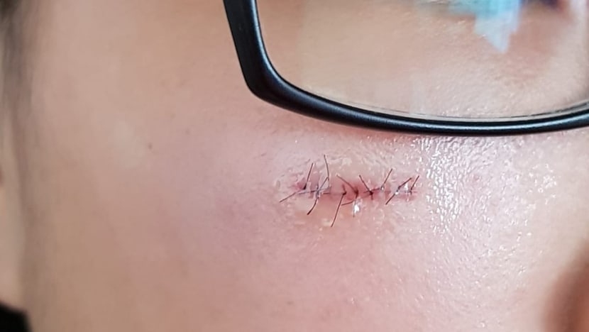 Teenager injured while playing at Jewel's Mirror Maze attraction