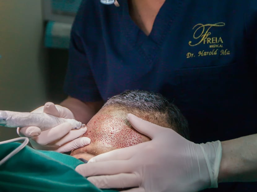 More men with hair loss opting for ‘that Wayne Rooney thing’