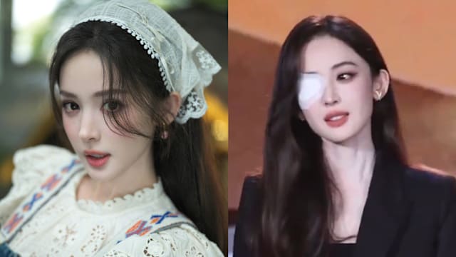 古力娜扎爆眼疾“情况不太妙”！右眼贴纱布亲吐病况：从小留病根
