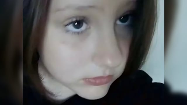 俄罗斯女生遭流浪狗围攻  头皮被撕裂两天后去世