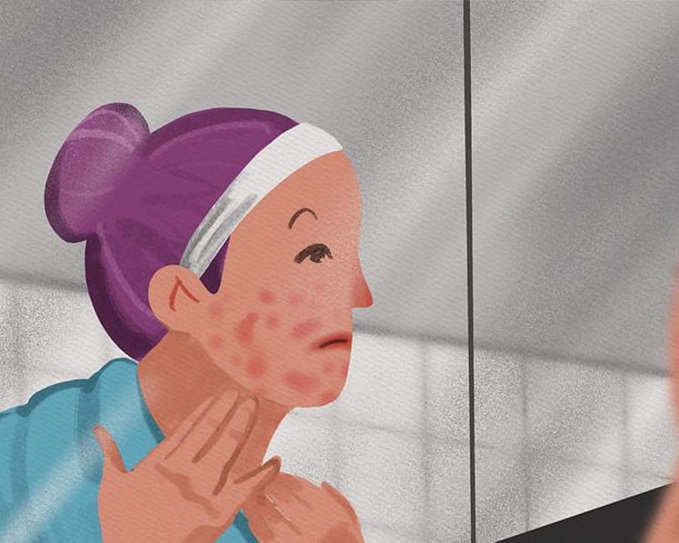 Using the wrong facial beauty products can cause eczema-prone skin to flare up