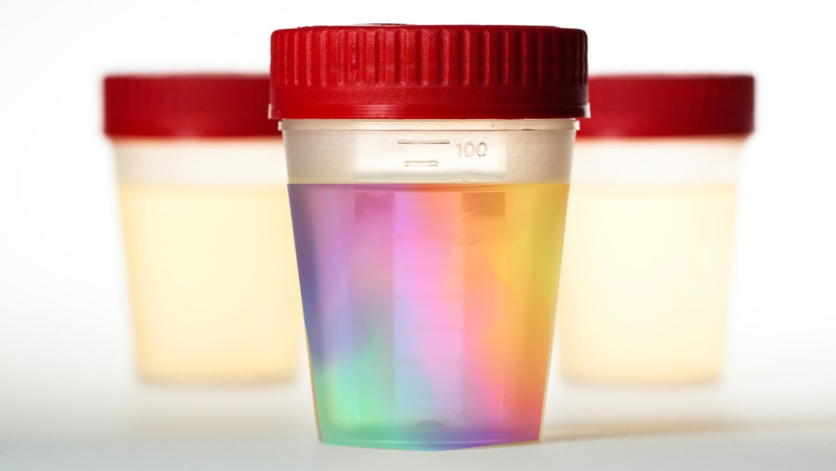 Pee Pattern What does the colour of your pee say about your health? - CNA Lifestyle