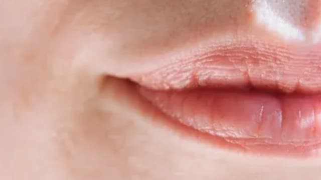 嘴巴“破洞”，这2种水果吃了恐加重病情