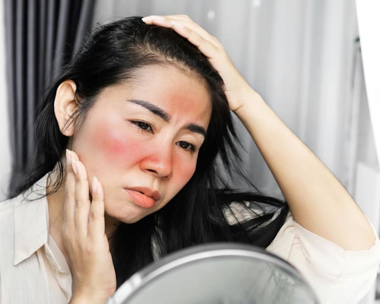 Do you get itchy, swollen, red rashes when you’re outside? You may have a case of 'sun allergy'
