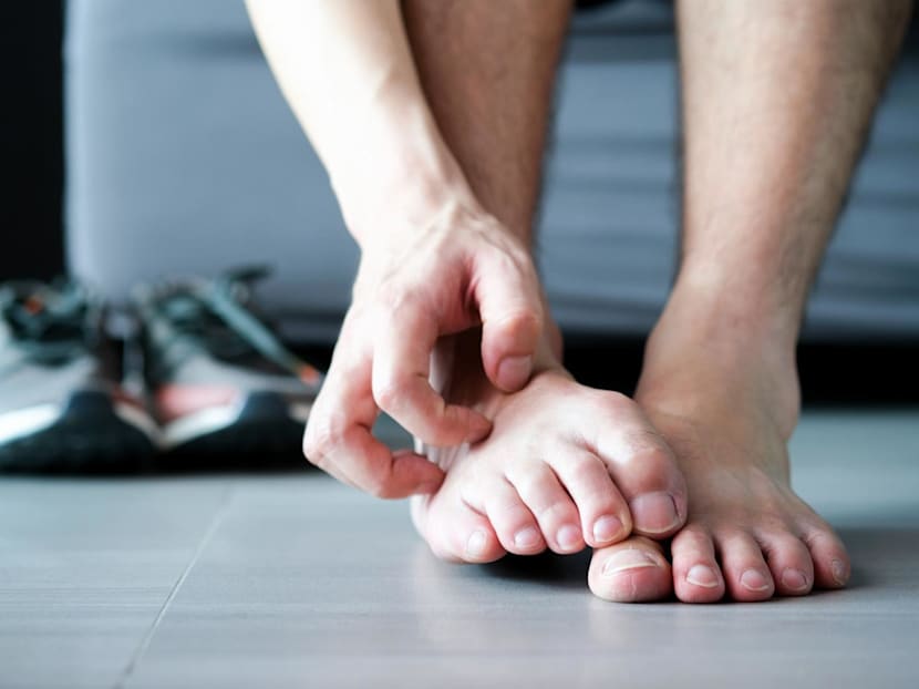 Why your athlete’s foot won’t go away – and how to finally clear it