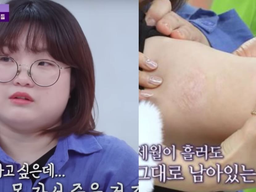 Korean Woman Recalls How She Was Tortured With A Curling Iron In School The Same Way As Song Hye Kyo’s Character In The Glory Korean Woman Recalls How She Was Tortured With A Curling Iron In School The Same Way As Song Hye Kyo’s Character In The Glory