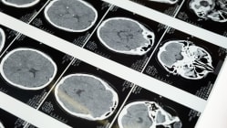 Related article image