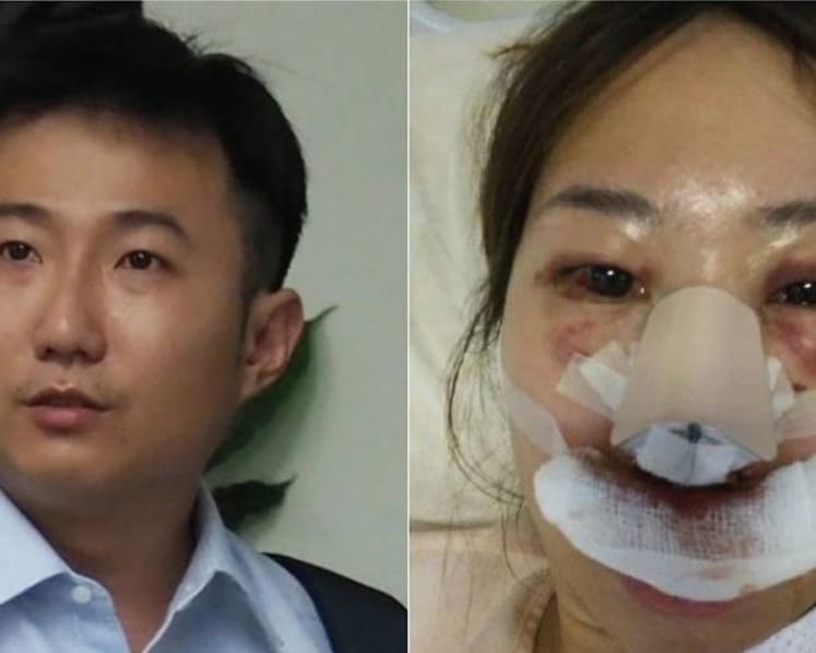 Doctor who says he can't recall attacking ex is 'lying' to fabricate a psychiatric defence: Prosecution