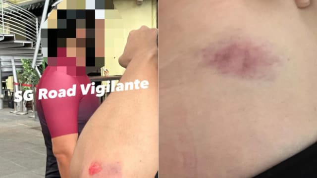 脚踏车骑士被指撞伤人 反指路人弄坏头盔