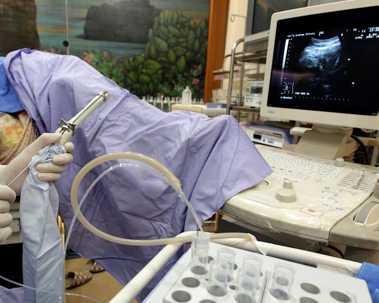 Tighten rules for doctors referring women to overseas facilities for social egg freezing