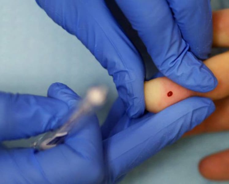 New HIV infections among Singapore residents up 10% after hitting two-decade low