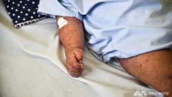Related article image