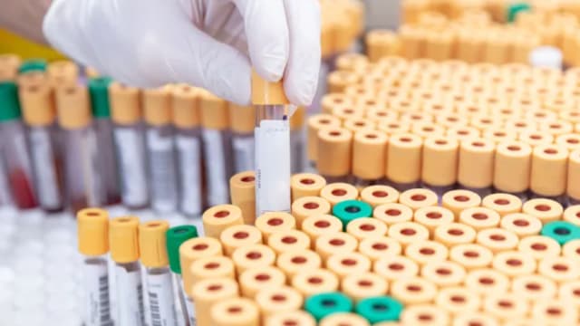 致命病毒样本不翼而飞 澳洲发生重大生物安全漏洞