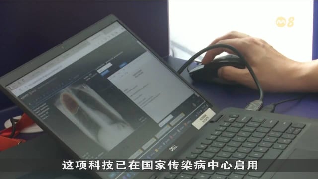 我国逐步引入人工智能技术改善医疗服务 包括检测肺结核及骨折