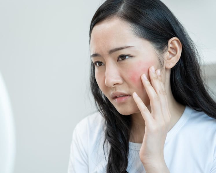 My face gets flushed and red more often – could it be rosacea, and why does it get worse with age?