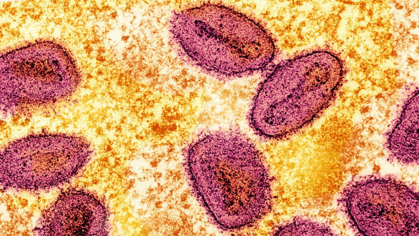 88 kasus mpox terdeteksi di Indonesia, hubungan seksual sesama lelaki beresiko jadi penyebab 88 kasus mpox terdeteksi di Indonesia, hubungan seksual sesama lelaki beresiko jadi penyebab