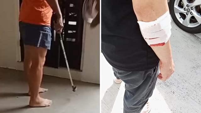 追债职员被欠债人攻击 57岁男子持械伤人被捕