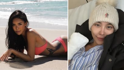 jessica_du_amputate_hand_1