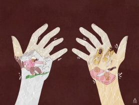 How my eczema taught me that there's no shame in giving up some dreams to take care of myself