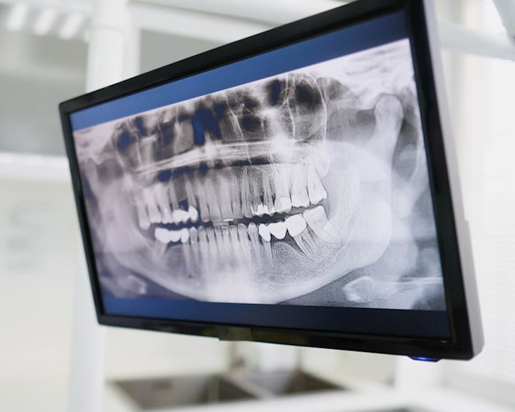 Dentist gets more than 3 years' jail after cheating CPF Board, MOH of S$11,750 in MediSave claims