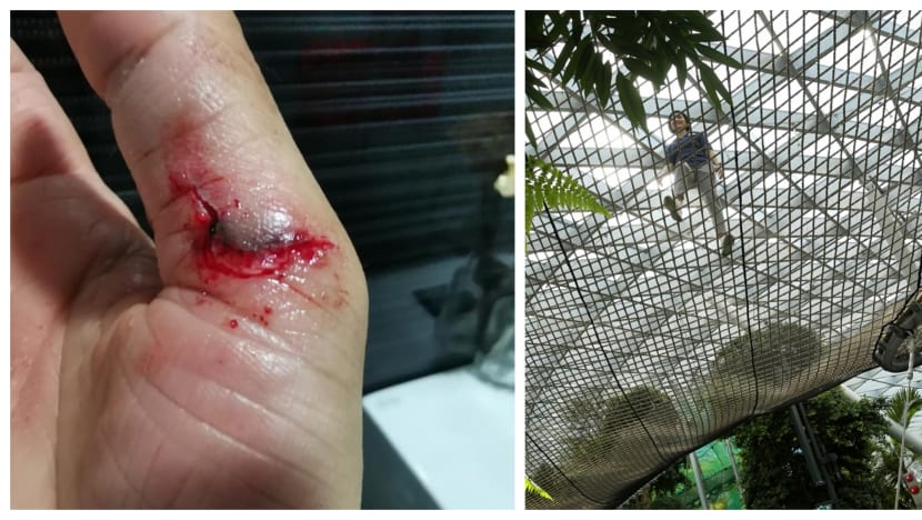 Woman sustains deep cut on hand after tripping at Jewel Sky Nets attraction