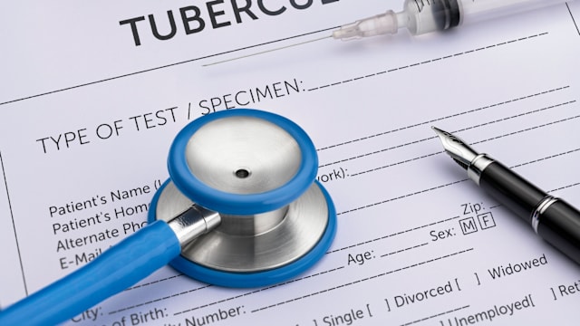 柔佛肺结核感染群确诊病例来自三个地区 六人是学生