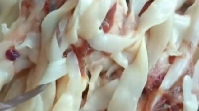 活鱼肚里挖出“一把面薄” 女子食后始知是寄生虫