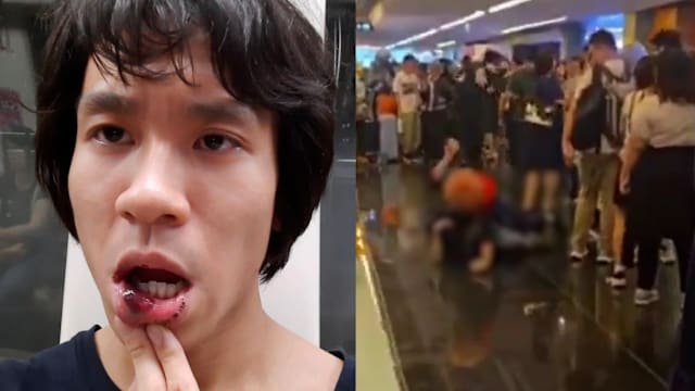 余澎杉在动漫展外被打 警方：一名18岁青年被捕