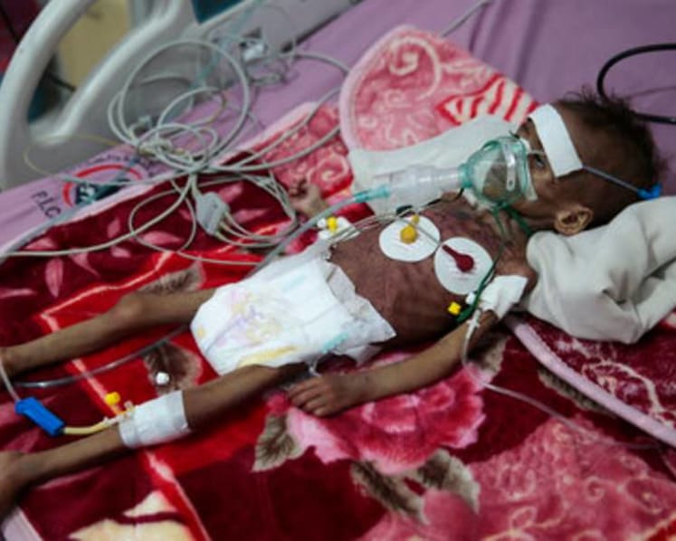 UN warns COVID-19 is `roaring back' as Yemen faces famine