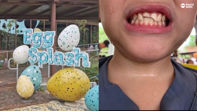 小孩在飞禽公园游乐场玩耍撞破牙 万态保育集团：已关闭游乐场待查