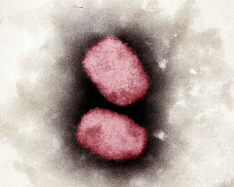 Monkeypox: MOH reaching out to ‘at-risk population’, including those engaging in high-risk sexual activities