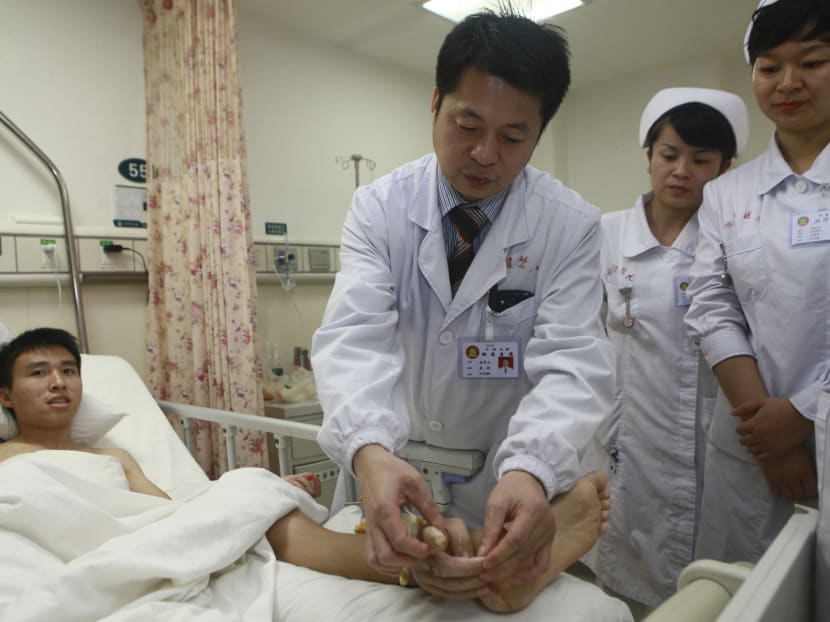 Severed hand stitched on man’s ankle to keep it alive