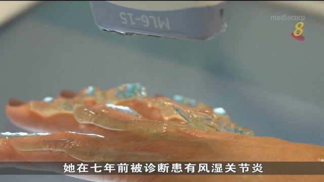丹麦医院研发机器人 12分钟内扫描便可诊断病患是否有关节炎