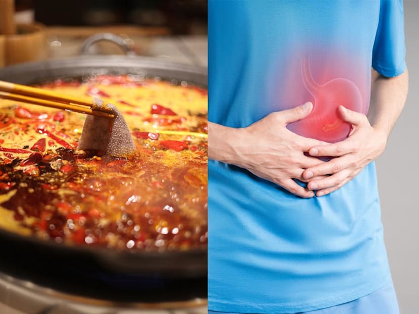 Can stress really cause stomach ulcers? What about spicy food and coffee?