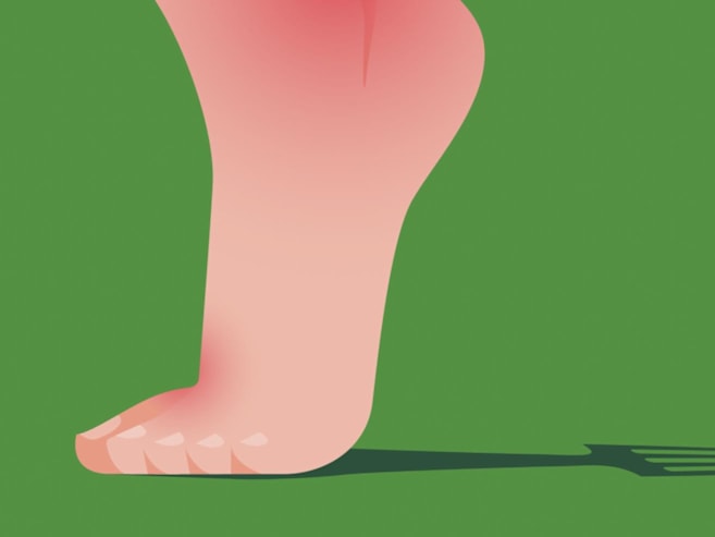 What exactly is gout – and why are more people getting it?