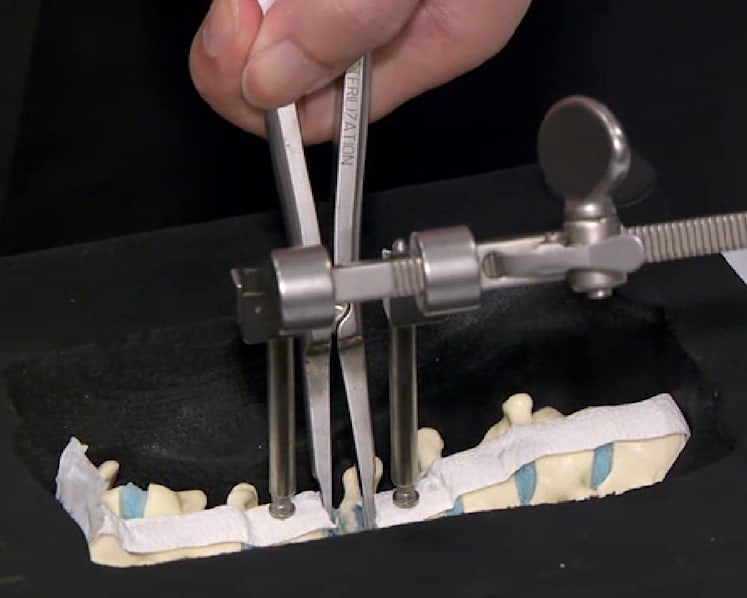 Singapore doctors develop new spinal surgery technique that reduces pain, improves mobility