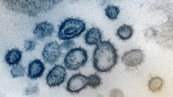 Related article image