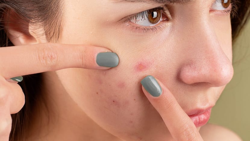 Related article image