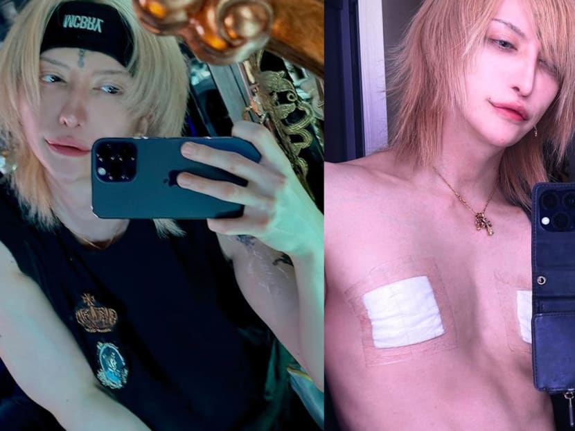 Japanese guitarist has surgery to remove his nipples, says 'men don&rsquo;t need them'