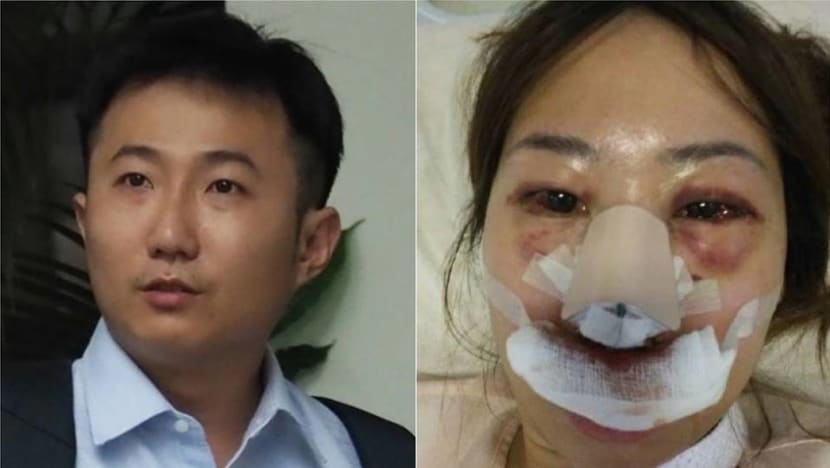 Doctor who says he can't recall attacking ex is 'lying' to fabricate a psychiatric defence: Prosecution
