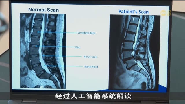 国大医院研发人工智能系统 助医生编写和解读报告
