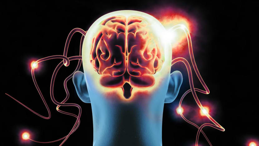 Commentary: MRI scans and AI could read what we’re thinking. The implications are terrifying Commentary: MRI scans and AI could read what we’re thinking. The implications are terrifying