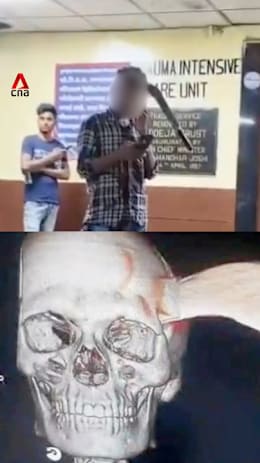 Man in India calmly walks into hospital with machete lodged in skull after attack
