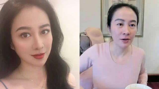 “古典美人”叶璇直播　前额位置一片秃惊呆网友