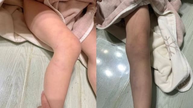 台湾幼儿园疑涉虐童 女童半夜惊醒喊“不要！”