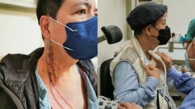 金钟主持人癌末开刀　12cm伤疤曝光