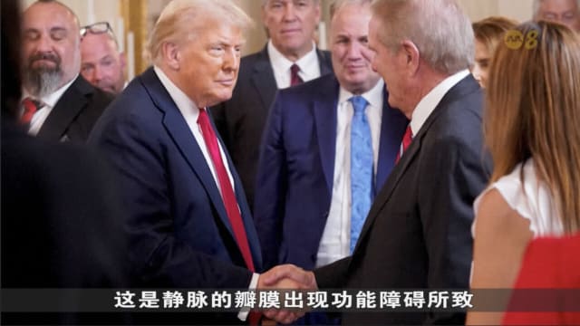 特朗普被确诊慢性静脉功能不全