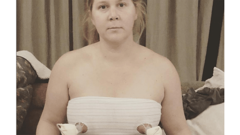 Amy Schumer shares breast pumping snap