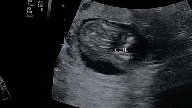 马国女子得知怀女婴后哭泣被批 揭背后心酸原因